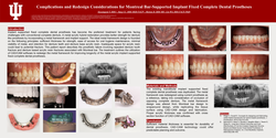 Thumbnail for <p>Complications and Redesign Considerations for Montreal Bar-Supported Implant Fixed Complete Dental Prostheses</p> 
<p> </p>