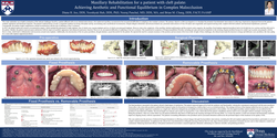 Thumbnail for Maxillary Rehabilitation for a patient with cleft palate: Achieving Aesthetic and Functional Equilibrium in Complex Malocclusion 