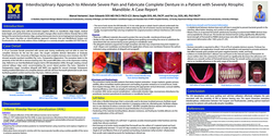 Thumbnail for Interdisciplinary Approach to Alleviate Severe Pain and Fabricate Complete Denture in a Patient with Severely Atrophic Mandible: A Case Report