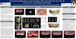Thumbnail for Incorporating Digital Wax-up with 2D photo, CBCT, and Intra-oral Scan into 3D Printed Crown Lenghtening Guide Design 