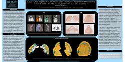 Thumbnail for A CAD/CAM Approach to Treatment of an Edentulous Patient with Microstomia