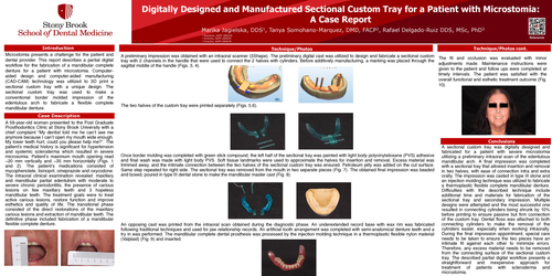 Preview of Digitally Designed and Manufactured Sectional Custom Tray for a Patient with Microstomia
