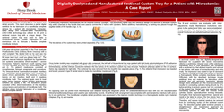 Thumbnail for Digitally Designed and Manufactured Sectional Custom Tray for a Patient with Microstomia