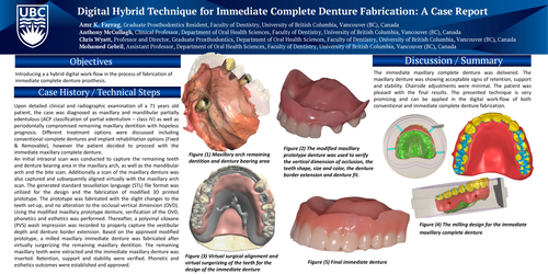 Preview of Immediate Complete Denture Fabrication using a Digital Hybrid Technique: A Case Report