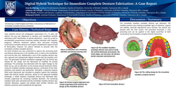 Thumbnail for Immediate Complete Denture Fabrication using a Digital Hybrid Technique: A Case Report