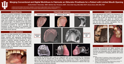 Thumbnail for Merging Conventional and Digital Workflows to Fabricate an Obturator Prosthesis for a Patient with Limited Mouth Opening