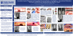 Thumbnail for Immediate Implant Placement and Immediate Provisionalization using Digital vs. Conventional Fabrication Techniques with Bis-Acryl: Literature review and Case Report