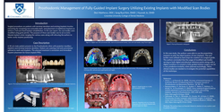 Thumbnail for Prosthodontic Management of Fully Guided implant Surgery Utilizing Existing Implants with Modified Scan Bodies 