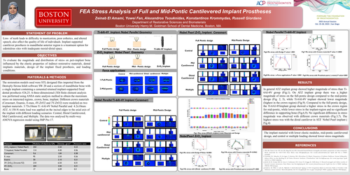 Preview of Stress Analysis FEA of Full Pontic cantilevered and Mid Pontic cantilevered Implant fixed Prosthesis