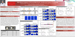 Thumbnail for Stress Analysis FEA of Full Pontic  cantilevered and Mid Pontic  cantilevered Implant fixed Prosthesis 