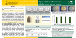 Thumbnail for Fracture Strength of CAD/CAM Lithium Disilicate Partial Coverage Restorations with Various Designs