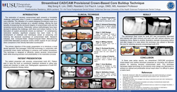 Thumbnail for Streamlined CAD/CAM Provisional Crown-Based Core Buildup Technique for Enhanced Restorative Dentistry