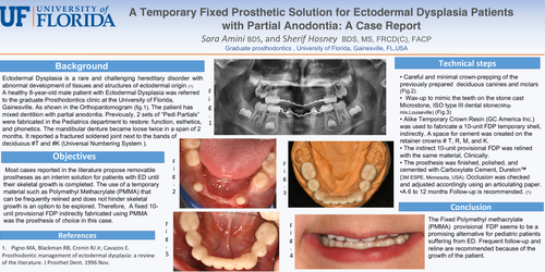 Preview of A Temporary Fixed Prosthetic Solution for Ectodermal dysplasia with partial anodontia: A case report.