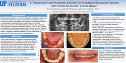 Preview of A Temporary Fixed Prosthetic Solution for Ectodermal dysplasia with partial anodontia: A case report.