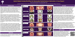 Preview of Hybrid Digital-Analog Workflow for Removable Partial Denture Fabrication: A Case Report