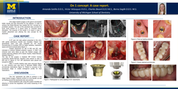 Thumbnail for Case report: On-1 Concept.