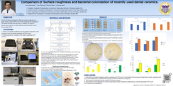 Preview of Comparison of Surface roughness and bacterial colonization of recently used dental ceramics.