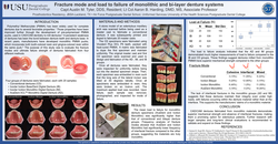 Preview of Mechanical Characteristics and Fracture Modes of Dentures Fabricated by Different Methods: A Comparative Study