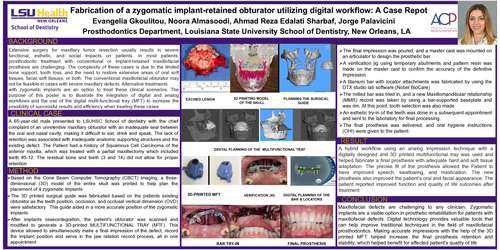 Preview of Fabrication of a zygomatic implant-retained obturator utilizing digital workflow: A Case Report