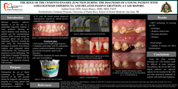Thumbnail for The role of the Cementoenamel junction during the diagnosis of a young patient with amelogenesis imperfecta and delayed passive eruption: a case report.