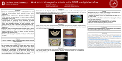 Thumbnail for Work around strategies for artifacts in the CBCT in a digital workflow.