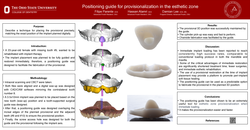 Thumbnail for Positioning guide for provisionalization in the esthetic zone