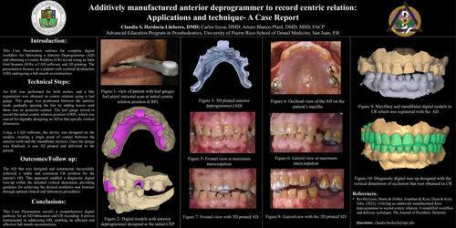 Preview of Additively manufactured anterior deprogrammer to record centric relation: Applications and technique- A Case Report