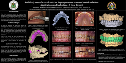 Thumbnail for Additively manufactured anterior deprogrammer to record centric relation: Applications and technique- A Case Report