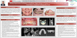Thumbnail for Pickup Impression Technique to Facilitate Digital Merge of Patient Provisional Restorations with Cone Beam Computed Tomography Scan 