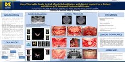 Thumbnail for <p>Use of stackable guide for a patient with history of advanced periodontal disease</p> 
<p> </p>