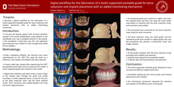 Thumbnail for Digital workflow for the fabrication of a tooth-supported stackable guide for bone reduction and implant placement with added interlocking mechanism