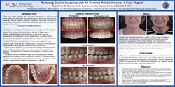 Thumbnail for Restoring Canine Guidance with All-Ceramic Palatal Veneers: A Case Report