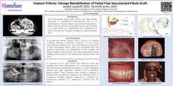 Thumbnail for Implant Trifecta: Salvaged Rehabilitation of Failed Free Vascularized Fibula Graft 
