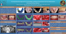 Thumbnail for Implant-Supported Guide: A Comprehensive Approach to Pick-up and Immediate Loading of Provisional All-on-x restoration