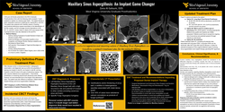 Thumbnail for Dental Implant Planning versus Maxillary Sinus Aspergillosis: A Case Report.