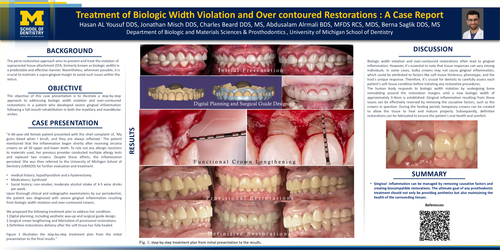 Preview of Treatment of Biologic Width Violation and Over-contoured Restorations: A case Report