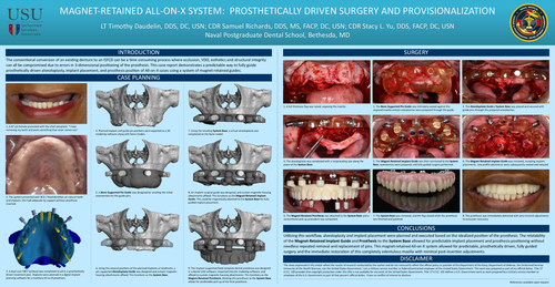 Preview of Magnet-Retained All-On-X System: Prosthetically Driven Surgery and Provisionalization