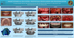 Thumbnail for Magnet-Retained All-On-X System: Prosthetically Driven Surgery and Provisionalization