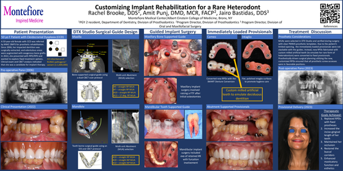 Preview of Customizing Implant Rehabilitation for a Rare Heterodont