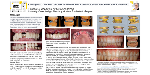 Preview of Chewing with Confidence: A Full Mouth Rehabilitation in a Geriatric Scissor Bite