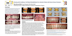 Thumbnail for Chewing with Confidence: A Full Mouth Rehabilitation in a Geriatric Scissor Bite