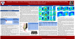 Thumbnail for Evaluating the changes in stress distribution around an implant with and without the presence of bone graft 