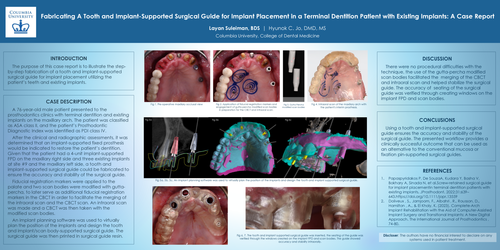 Preview of Fabricating a tooth and implant-supported surgical guide for implant placement in a terminal dentition patient with existing implants.