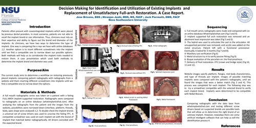 Preview of Prosthetic considerations in decision making for identifying and utilizing existing dental implants. A case report.