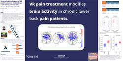 Thumbnail for MEASURING THE IMPACT OF VR PAIN TREATMENT ON THE BRAIN – A TIME-DOMAIN FUNCTIONAL NEAR-INFRARED SPECTROSCOPY PILOT STUDY