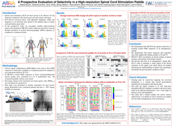 Thumbnail for A PROSPECTIVE EVALUATION OF SELECTIVITY IN A HIGH-RESOLUTION SPINAL CORD STIMULATION PADDLE
