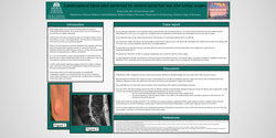 Thumbnail for CAUDAL EPIDURAL BLOOD PATCH PERFORMED FOR CEREBRAL SPINAL FLUID LEAK AFTER LUMBAR SURGERY