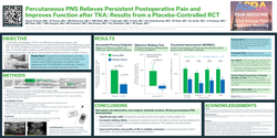 Thumbnail for PERCUTANEOUS PNS RELIEVES PERSISTENT POSTOPERATIVE PAIN AND IMPROVES FUNCTION AFTER TKA: RESULTS FROM A PLACEBO-CONTROLLED RCT