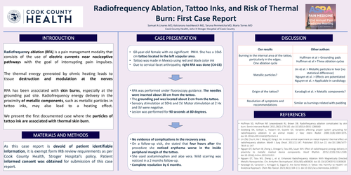 Preview of RADIOFREQUENCY ABLATION, TATTOO INKS, AND RISK OF THERMAL BURN: FIRST CASE REPORT