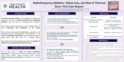 Thumbnail for RADIOFREQUENCY ABLATION, TATTOO INKS, AND RISK OF THERMAL BURN: FIRST CASE REPORT